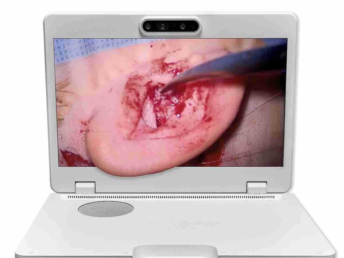 达擎之＂Heads-up 3D显微手术显示系统＂，，，，整合4K裸眼3D显示及眼球追踪系统，，具备快速追踪人眼移动位置功能，，减轻医师长时间维持固定姿势的负担，，，让医师能有更宽广清晰的3D立体视野及更舒适的姿势来执行手术。。。